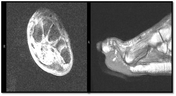 https://cdn.ncbi.nlm.nih.gov/pmc/blobs/3e0e/6604120/c18b564fa680/10.1177_2054270419853144-fig3.jpg