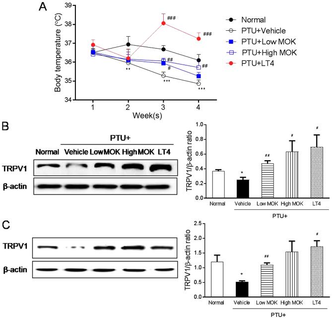 https://cdn.ncbi.nlm.nih.gov/pmc/blobs/3e0f/5995081/63d463624e53/etm-16-01-0310-g06.jpg
