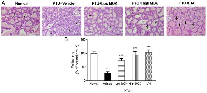 https://cdn.ncbi.nlm.nih.gov/pmc/blobs/3e0f/5995081/67e966aa1d4a/etm-16-01-0310-g04.jpg