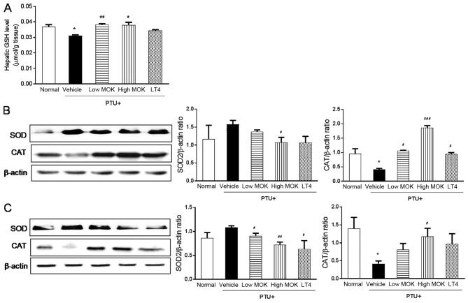 https://cdn.ncbi.nlm.nih.gov/pmc/blobs/3e0f/5995081/e201070fc7c8/etm-16-01-0310-g05.jpg