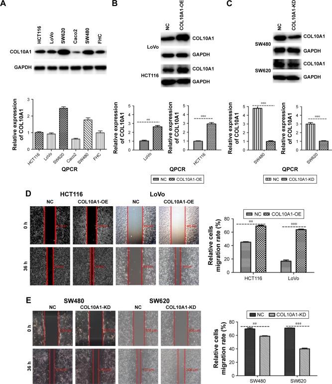 https://cdn.ncbi.nlm.nih.gov/pmc/blobs/3e19/5865565/22ce149af29c/ott-11-1571Fig2.jpg