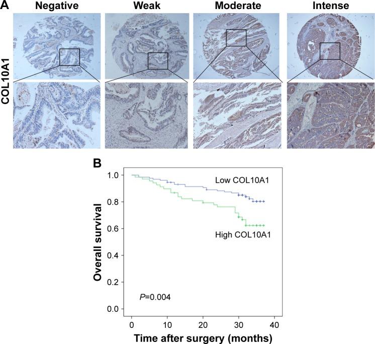 https://cdn.ncbi.nlm.nih.gov/pmc/blobs/3e19/5865565/6dfe6ca428fa/ott-11-1571Fig5.jpg