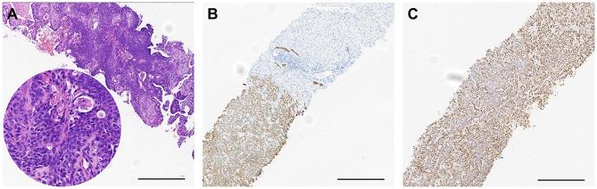 https://cdn.ncbi.nlm.nih.gov/pmc/blobs/3e23/12439690/c73cc55ab95c/OTT-18-1013-g0007.jpg