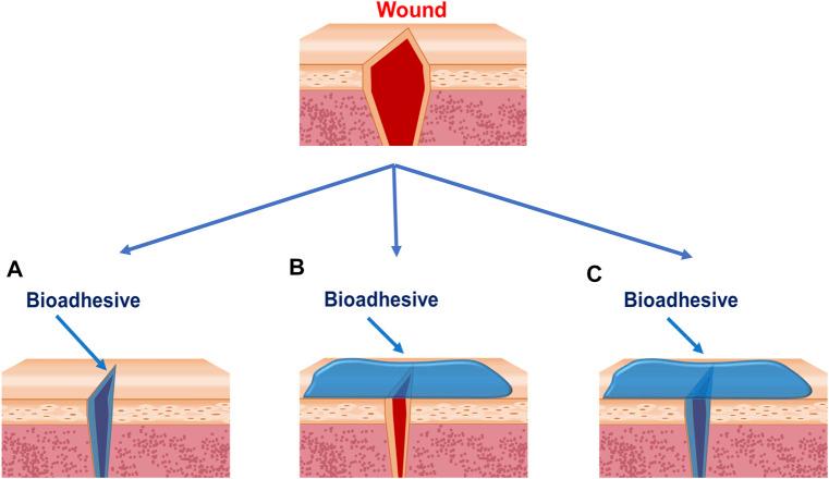 https://cdn.ncbi.nlm.nih.gov/pmc/blobs/3e2a/8446440/5c1d52bf764d/fbioe-09-716035-g002.jpg