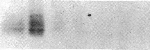 https://cdn.ncbi.nlm.nih.gov/pmc/blobs/3e3a/294535/4022b8769ba0/jcinvest00035-0463-a.jpg