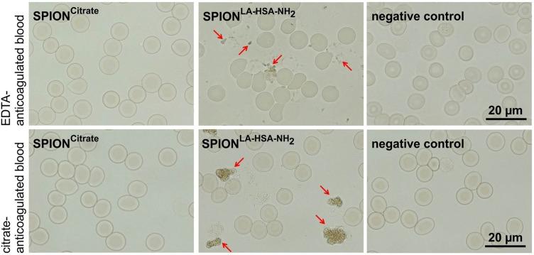 https://cdn.ncbi.nlm.nih.gov/pmc/blobs/3e3d/6817714/34910becee27/IJN-14-8421-g0002.jpg