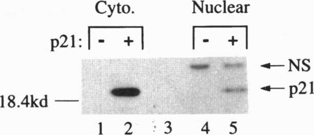 https://cdn.ncbi.nlm.nih.gov/pmc/blobs/3e3f/38847/661841046390/pnas01519-0493-c.jpg