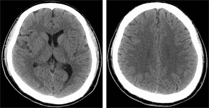 https://cdn.ncbi.nlm.nih.gov/pmc/blobs/3e46/6603319/1c4f635cc201/AMS2-6-308-g001.jpg