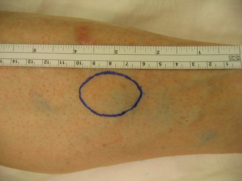 https://cdn.ncbi.nlm.nih.gov/pmc/blobs/3e4a/7538026/24f5ad713dd6/cureus-0012-00000010269-i01.jpg