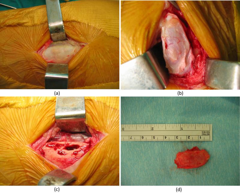 https://cdn.ncbi.nlm.nih.gov/pmc/blobs/3e4a/7538026/a32b2bd01a5f/cureus-0012-00000010269-i03.jpg