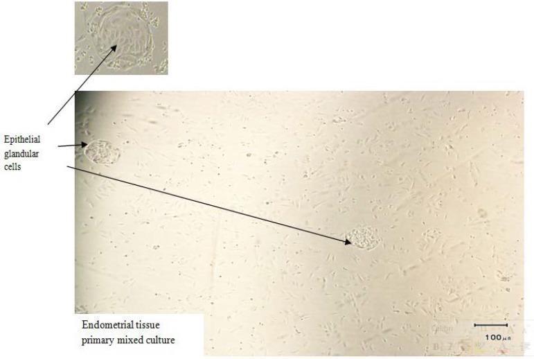 https://cdn.ncbi.nlm.nih.gov/pmc/blobs/3e51/4330655/a001350d49ff/ijrm-12-755-g002.jpg