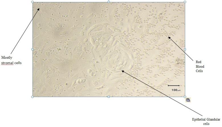 https://cdn.ncbi.nlm.nih.gov/pmc/blobs/3e51/4330655/d3f553fb6577/ijrm-12-755-g001.jpg