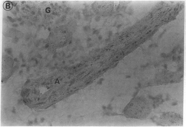 https://cdn.ncbi.nlm.nih.gov/pmc/blobs/3e53/287974/a686c32d6230/jcinvest00037-0165-b.jpg