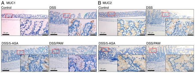 https://cdn.ncbi.nlm.nih.gov/pmc/blobs/3e55/12150364/c4c58c040637/etm-30-01-12896-g05.jpg