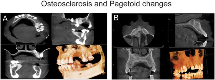 https://cdn.ncbi.nlm.nih.gov/pmc/blobs/3e58/10985038/19847384fce9/gr4.jpg