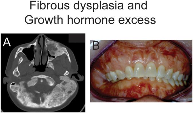 https://cdn.ncbi.nlm.nih.gov/pmc/blobs/3e58/10985038/bbe92b371eb1/gr1.jpg