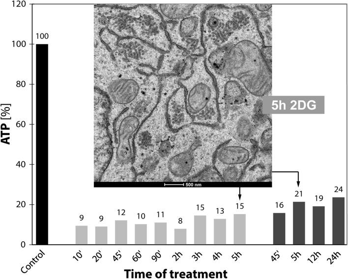 https://cdn.ncbi.nlm.nih.gov/pmc/blobs/3e5a/5359389/a031afd40945/418_2016_1515_Fig7_HTML.jpg