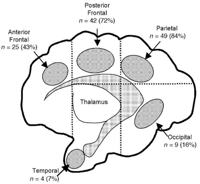 https://cdn.ncbi.nlm.nih.gov/pmc/blobs/3e5f/12191494/a6c328015b5e/children-12-00768-g003.jpg