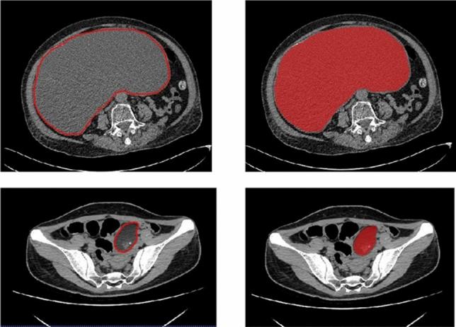https://cdn.ncbi.nlm.nih.gov/pmc/blobs/3e62/8062553/f650d038e3c9/41598_2021_87775_Fig1_HTML.jpg