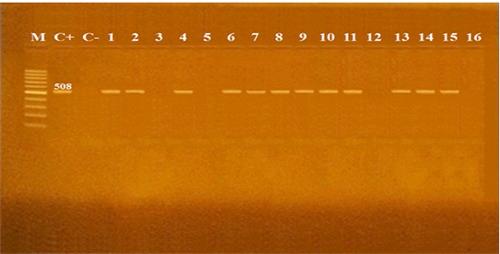 https://cdn.ncbi.nlm.nih.gov/pmc/blobs/3e73/6784595/fc2ae6d6a241/ijfs-8-3-8291-g002.jpg