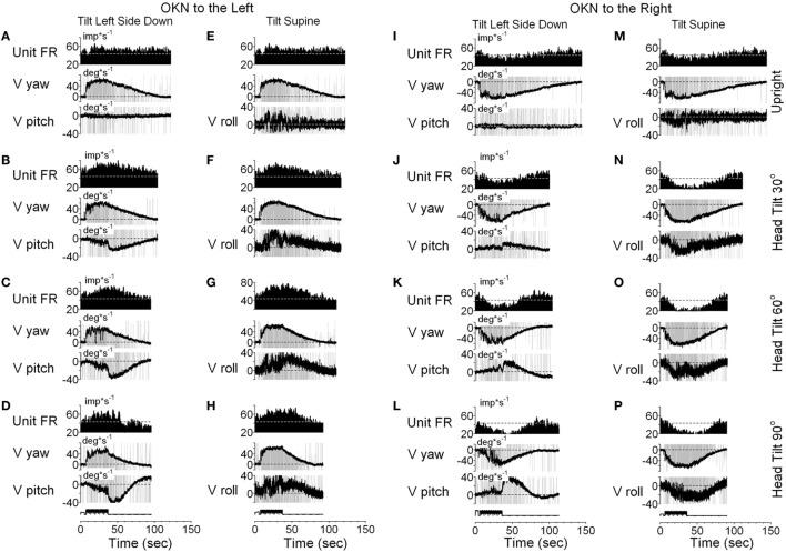 https://cdn.ncbi.nlm.nih.gov/pmc/blobs/3e76/5561016/c8875d786b5a/fneur-08-00386-g011.jpg