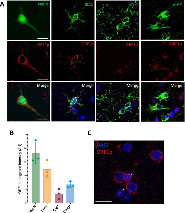 https://cdn.ncbi.nlm.nih.gov/pmc/blobs/3e7c/11602836/50692f0a5cc2/401_2024_2835_Fig1_HTML.jpg