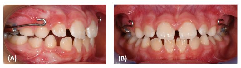 https://cdn.ncbi.nlm.nih.gov/pmc/blobs/3e7e/9181288/2210aa87301c/materials-15-03747-g004a.jpg