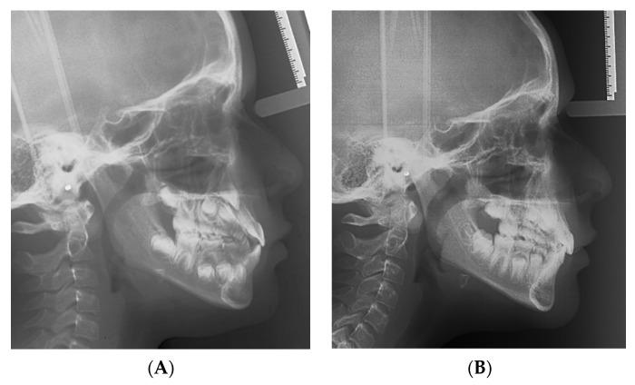 https://cdn.ncbi.nlm.nih.gov/pmc/blobs/3e7e/9181288/6430b1caaa06/materials-15-03747-g003.jpg
