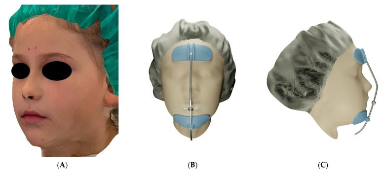 https://cdn.ncbi.nlm.nih.gov/pmc/blobs/3e7e/9181288/968ebba75950/materials-15-03747-g005.jpg