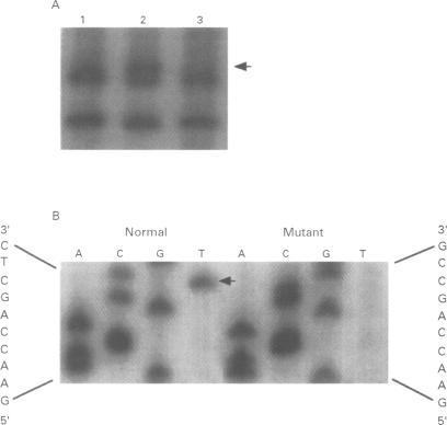 https://cdn.ncbi.nlm.nih.gov/pmc/blobs/3e84/1051454/820ebd5d9861/jmedgene00239-0019-a.jpg