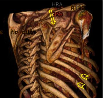 https://cdn.ncbi.nlm.nih.gov/pmc/blobs/3e88/11129897/0bb32f87ed44/SRP2024-3550087.001.jpg