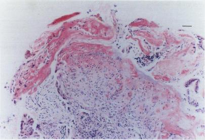 https://cdn.ncbi.nlm.nih.gov/pmc/blobs/3e8a/1382355/283628d86541/gut00519-0082-a.jpg