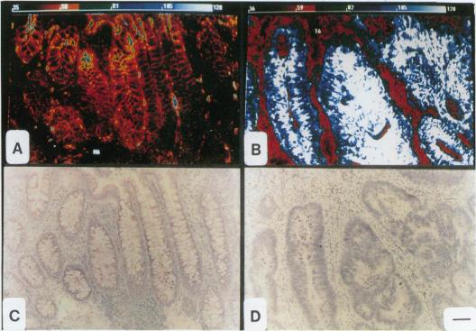 https://cdn.ncbi.nlm.nih.gov/pmc/blobs/3e8a/1382355/e4e7fef3b44d/gut00519-0080-a.jpg