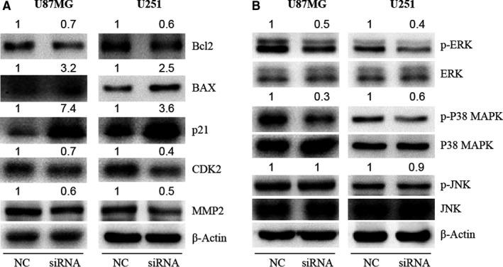 https://cdn.ncbi.nlm.nih.gov/pmc/blobs/3e8a/7579713/9fd9a53a0ab4/JCMM-24-11691-g005.jpg