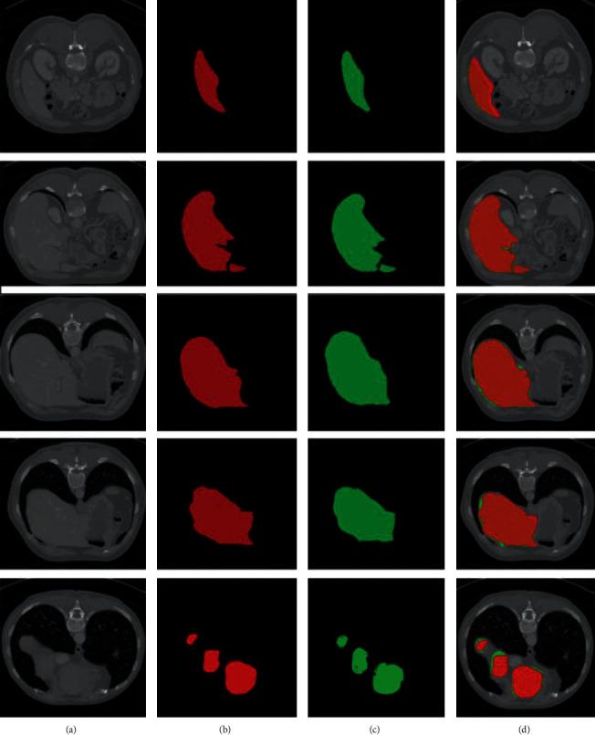 https://cdn.ncbi.nlm.nih.gov/pmc/blobs/3e95/9225858/5cd2f5e61b77/CIN2022-7954333.009.jpg