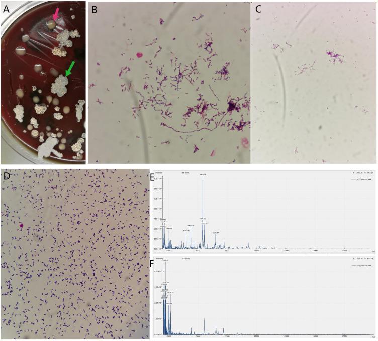 https://cdn.ncbi.nlm.nih.gov/pmc/blobs/3e9b/12375319/2b40ad9d29cc/IDR-18-4207-g0002.jpg