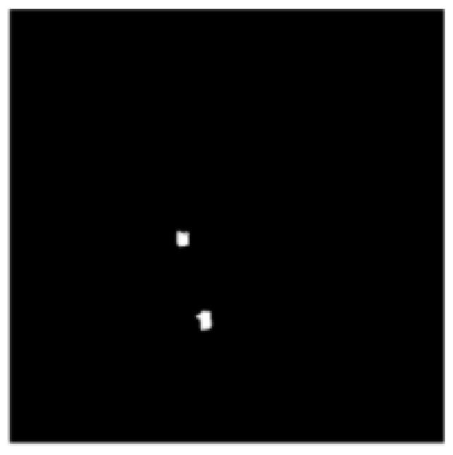 https://cdn.ncbi.nlm.nih.gov/pmc/blobs/3e9e/10527859/131a4380b759/diagnostics-13-02924-g009.jpg