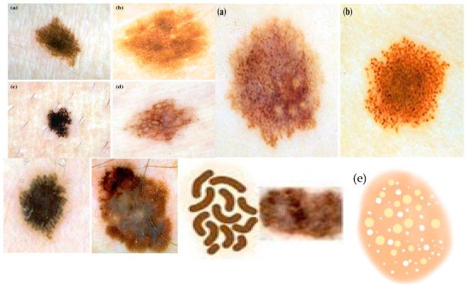 https://cdn.ncbi.nlm.nih.gov/pmc/blobs/3e9e/10527859/1528c791d315/diagnostics-13-02924-g002.jpg