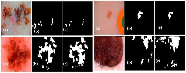 https://cdn.ncbi.nlm.nih.gov/pmc/blobs/3e9e/10527859/35df752f24b8/diagnostics-13-02924-g013.jpg
