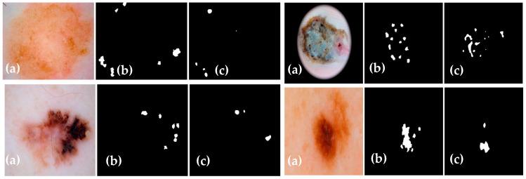 https://cdn.ncbi.nlm.nih.gov/pmc/blobs/3e9e/10527859/3fb5f3b61eea/diagnostics-13-02924-g012.jpg