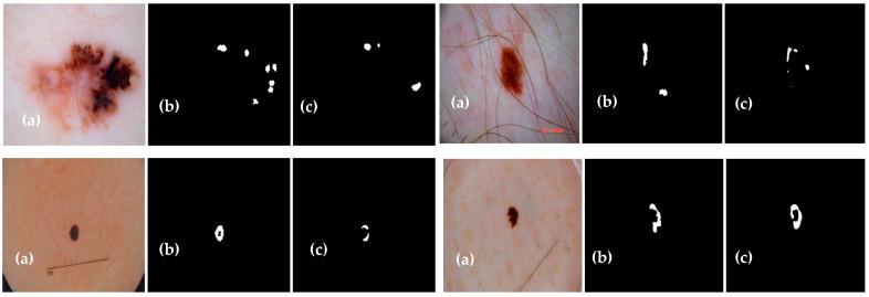 https://cdn.ncbi.nlm.nih.gov/pmc/blobs/3e9e/10527859/759b20339a7f/diagnostics-13-02924-g014.jpg
