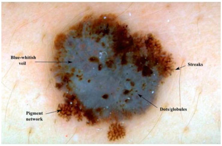 https://cdn.ncbi.nlm.nih.gov/pmc/blobs/3e9e/10527859/912169a2833a/diagnostics-13-02924-g001.jpg