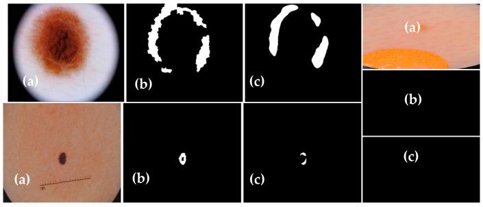 https://cdn.ncbi.nlm.nih.gov/pmc/blobs/3e9e/10527859/93ef4009b98c/diagnostics-13-02924-g011.jpg