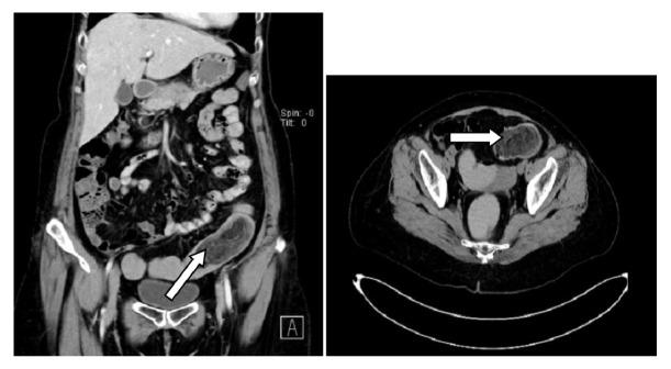 https://cdn.ncbi.nlm.nih.gov/pmc/blobs/3e9f/6444259/0fa0707e20ee/CRIGM2019-1896275.002.jpg