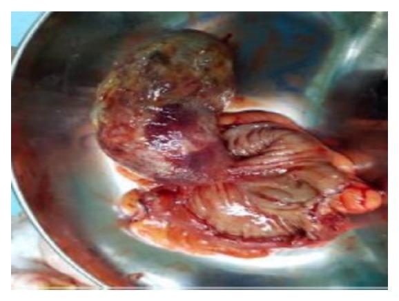 https://cdn.ncbi.nlm.nih.gov/pmc/blobs/3e9f/6444259/82c185f0fa58/CRIGM2019-1896275.003.jpg