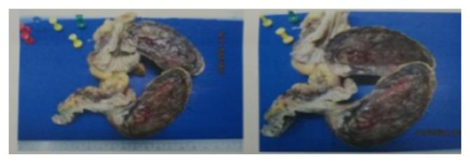 https://cdn.ncbi.nlm.nih.gov/pmc/blobs/3e9f/6444259/b66bec52dc82/CRIGM2019-1896275.004.jpg