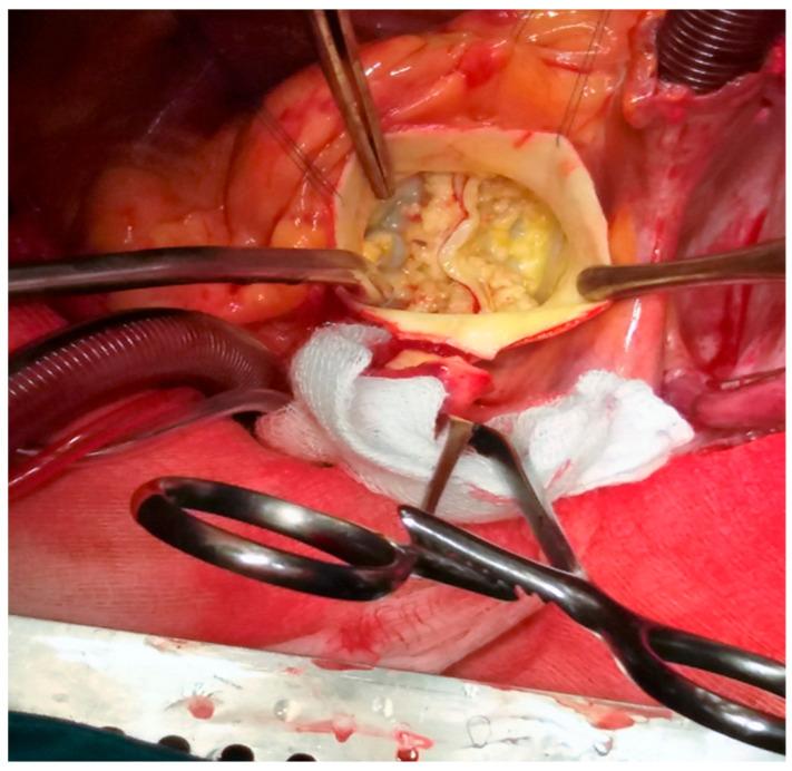 https://cdn.ncbi.nlm.nih.gov/pmc/blobs/3ea3/12387331/ad7008e6fa0b/jpm-15-00337-g001.jpg