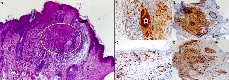 https://cdn.ncbi.nlm.nih.gov/pmc/blobs/3ea4/7872302/15d621e0edd0/pntd.0009089.g005.jpg