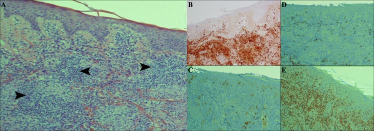 https://cdn.ncbi.nlm.nih.gov/pmc/blobs/3ea4/7872302/c49af3864ebf/pntd.0009089.g006.jpg