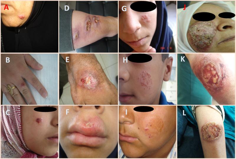 https://cdn.ncbi.nlm.nih.gov/pmc/blobs/3ea4/7872302/dce9beb60f5d/pntd.0009089.g001.jpg